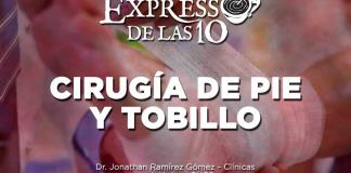 Cirugía De Pie y Tobillo - El Expresso de las 10 - Ma. 26 Septiembre 2023