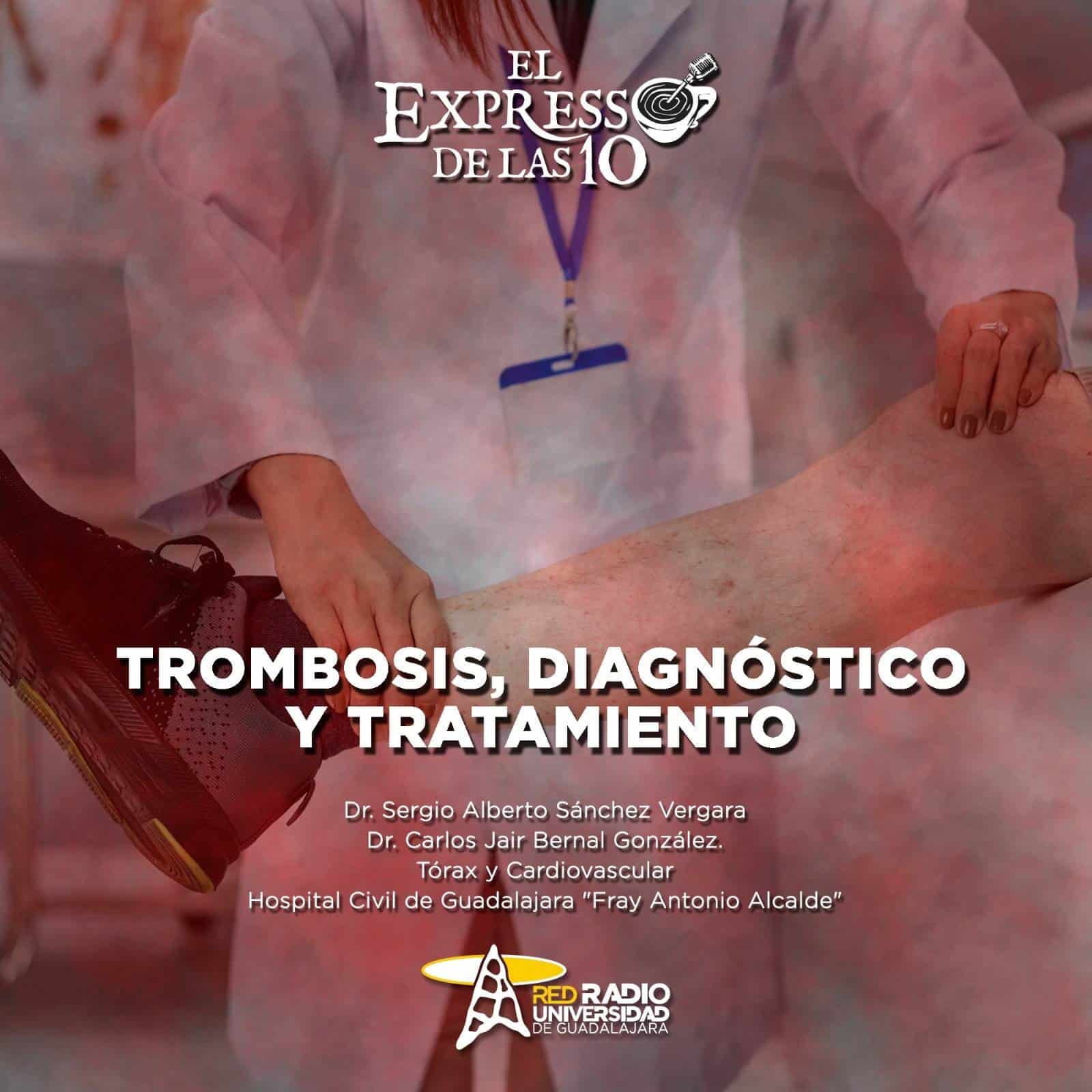 TROMBOSIS, DIAGNÓSTICO Y TRATAMIENTO - El Expresso de las 10 - Ma. 24 Octubre 2023