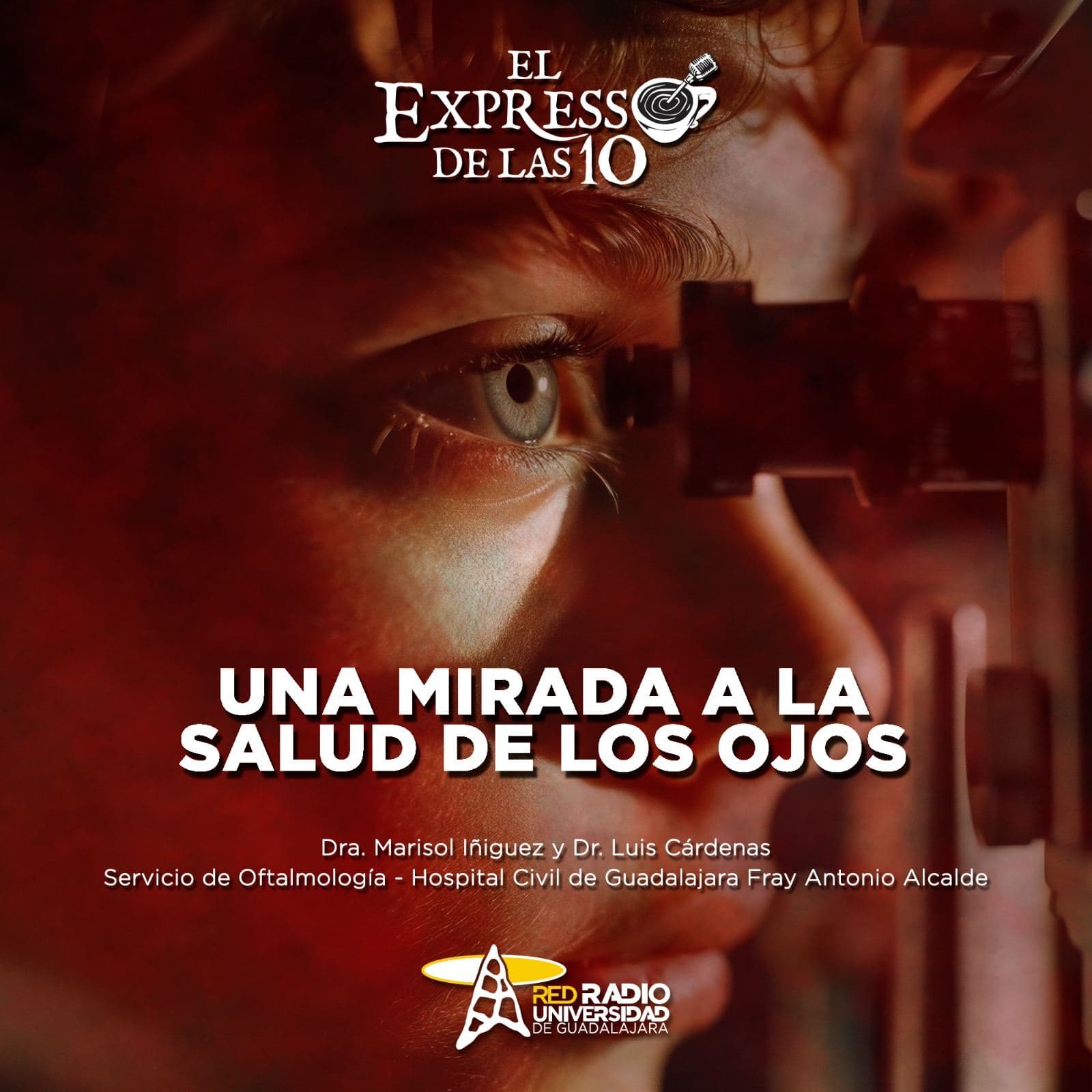 Una mirada a la salud de los ojos – El Expresso de las 10 – Ma. 30 Abril 2024