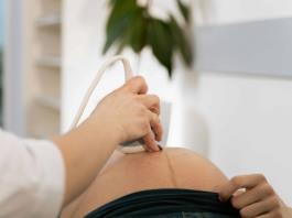 A pesar de existir una prueba para predecir la preeclampsia en embarazadas, el sector salud no cuenta con ella