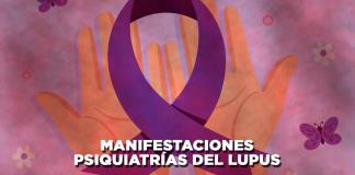 Manifestaciones psiquiátricas del lupus - El Expresso de las 10 - Ma. 06 Agosto 2024