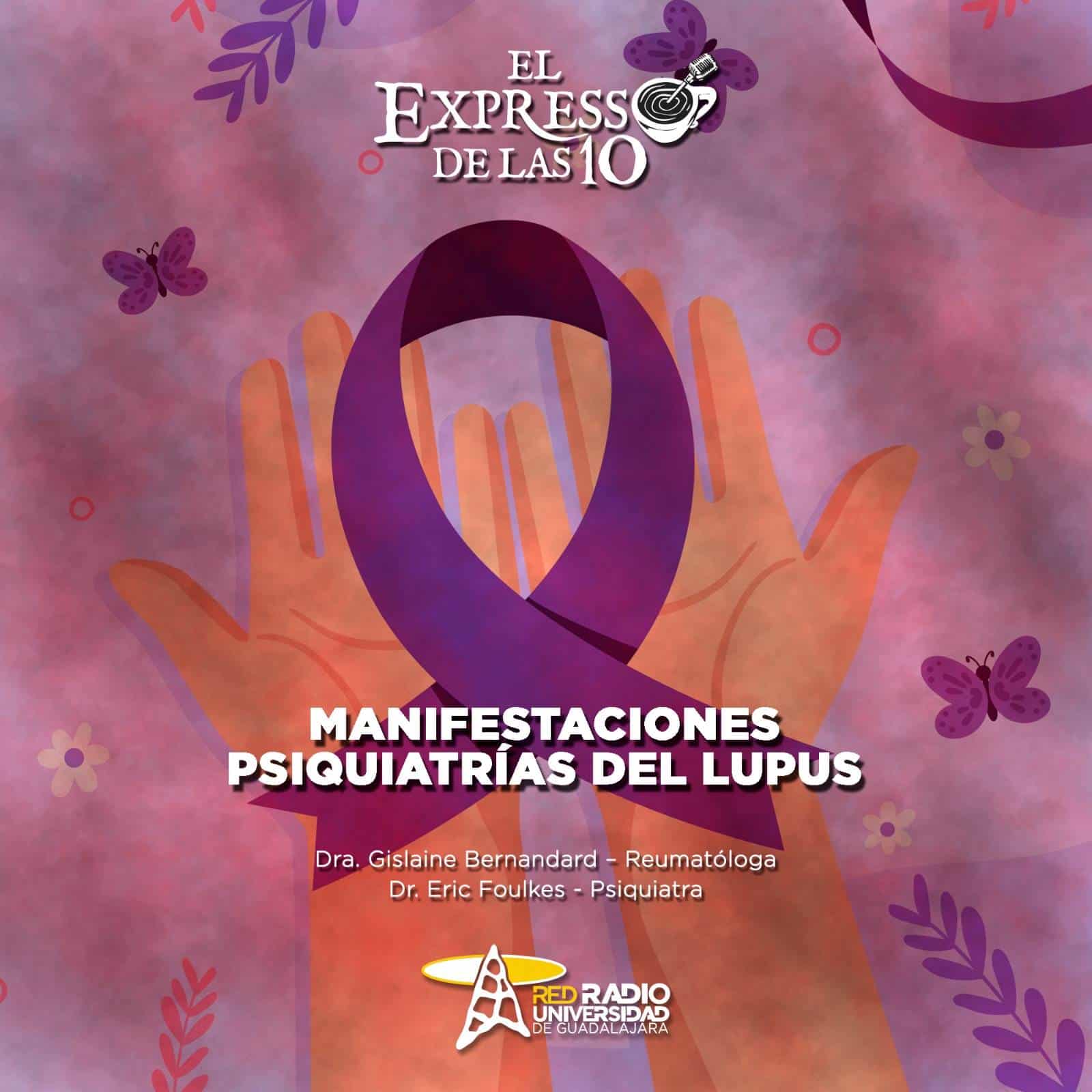 Manifestaciones psiquiátricas del lupus - El Expresso de las 10 - Ma. 06 Agosto 2024