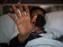 Jalisco registra 43 casos de Mpox en el primer semestre del año