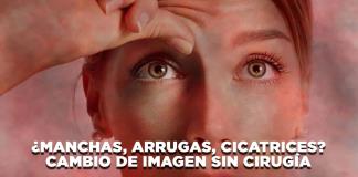 ¿Manchas, Arrugas, Cicatrices? Cambio de imagen sin cirugía - El Expresso de las 10 - Lu. 09 Septiembre 2024