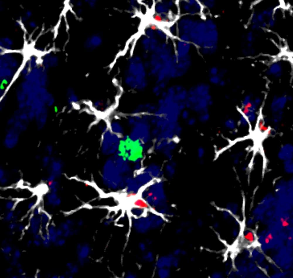 Investigadores chinos logran avance en tratamiento de precisión para cáncer de tiroides