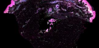 El mapa unicelular de la piel aporta una receta para reconstruirla y prevenir cicatrices