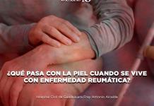 ¿Qué pasa con la piel cuando se vive con enfermedad reumática? - El Expresso de las 10 - Ma. 05 Noviembre 2024