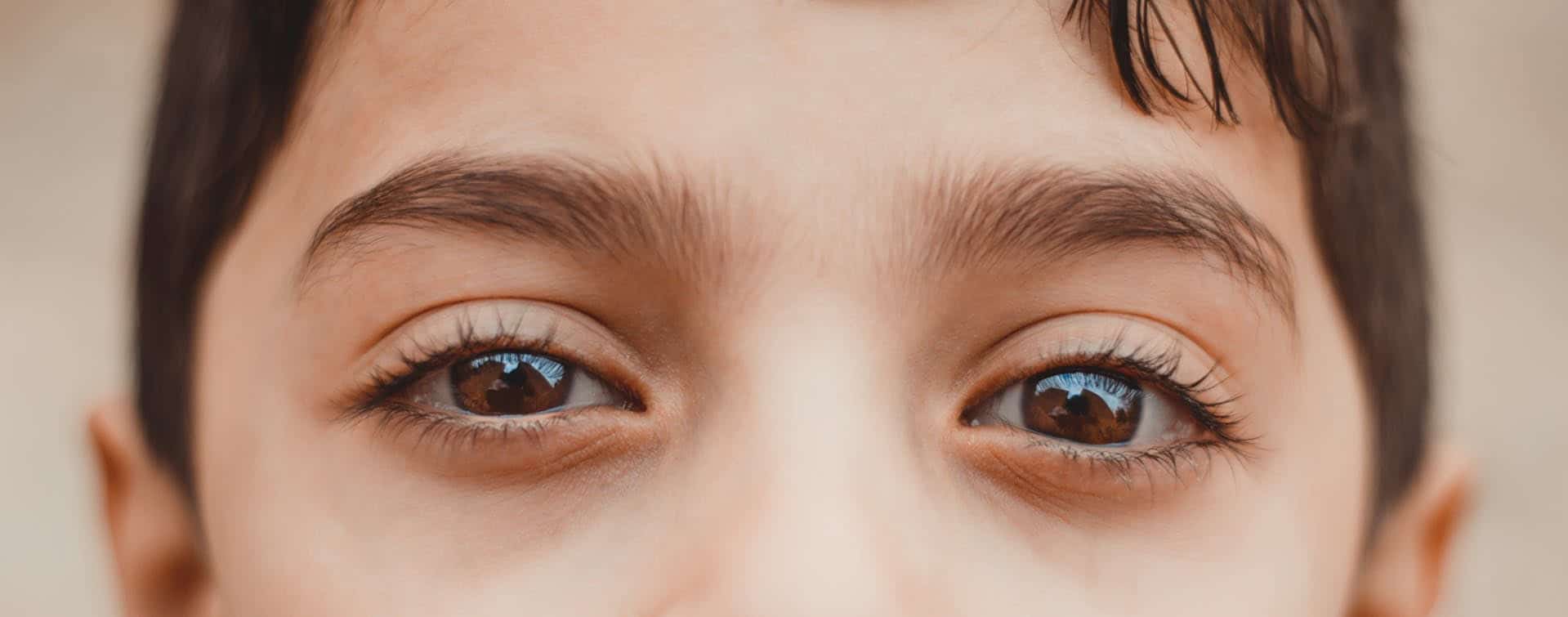 Cuidado con el reflejo blanco en los ojos de tus hijos: podría ser una enfermedad más grave