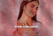 Vivir con lupus - El Expresso de las 10 - Ma. 04 Febrero 2025 