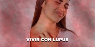 Vivir con lupus - El Expresso de las 10 - Ma. 04 Febrero 2025 