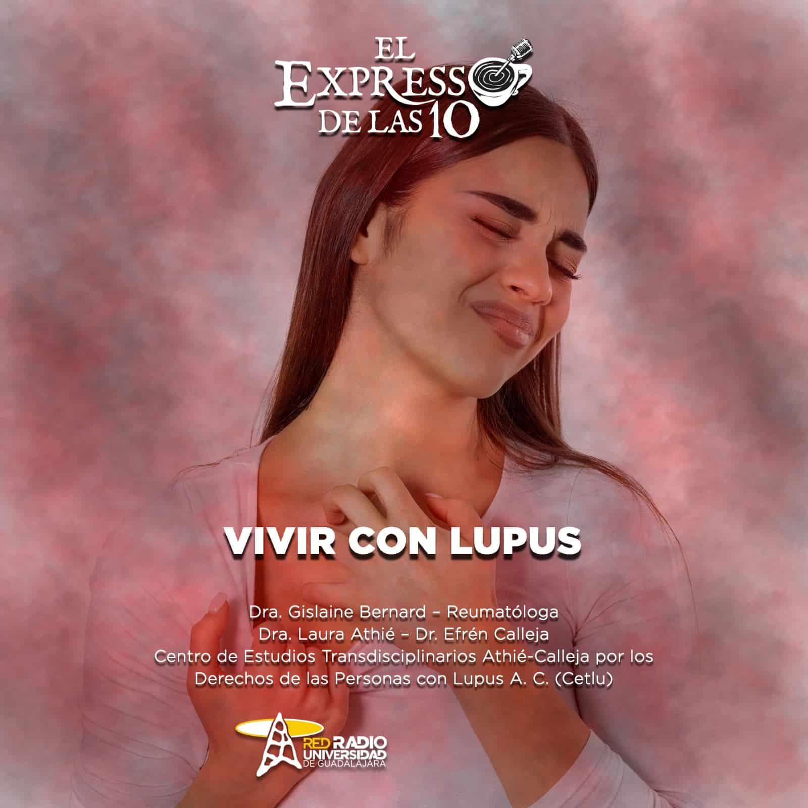 Vivir con lupus - El Expresso de las 10 - Ma. 04 Febrero 2025 