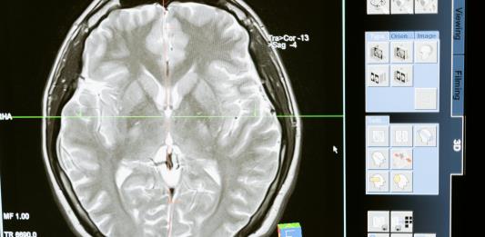 Atención a la salud mental en jóvenes: un desafío para las universidades
