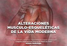 Alteraciones músculo-esqueléticas de la vida moderna - El Expresso de las 10 - Vi. 04 Abril 2025