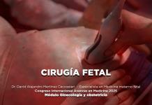 Cirugía fetal - El Expresso de las 10 - Ju. 03 Abril 2025