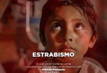 Estrabismo - El Expresso de las 10 - Ju. 03 Abril 2025