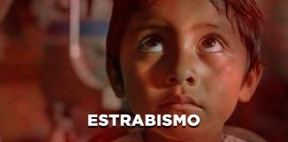 Estrabismo - El Expresso de las 10 - Ju. 03 Abril 2025