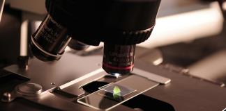 Funcionario de la OMS desmiente rumores sobre nuevo virus en Rusia