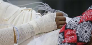 Expertos alertan de quemaduras en adolescentes en México por bromas o pugnas del crimen