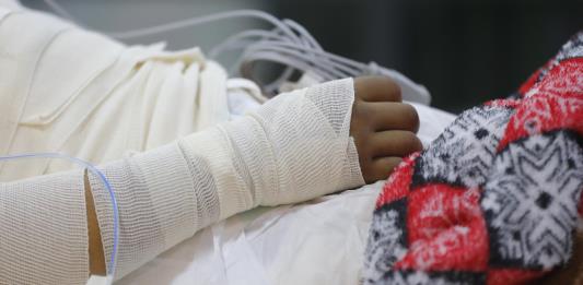 Expertos alertan de quemaduras en adolescentes en México por bromas o pugnas del crimen