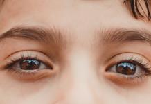 Reflejo blanco en los ojos de los bebés o niños no es normal, advierte especialista
