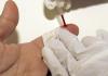 Desarrollan una inmunoterapia para revertir el daño cardíaco debido al colesterol