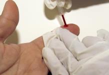 Desarrollan una inmunoterapia para revertir el daño cardíaco debido al colesterol