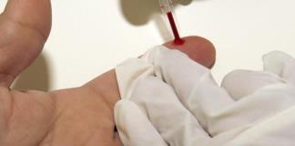 Desarrollan una inmunoterapia para revertir el daño cardíaco debido al colesterol