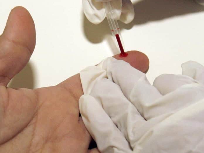 Desarrollan una inmunoterapia para revertir el daño cardíaco debido al colesterol