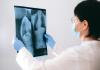 La pérdida de capacidad pulmonar comienza entre los 20 y los 25 años