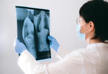 La pérdida de capacidad pulmonar comienza entre los 20 y los 25 años