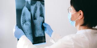 La pérdida de capacidad pulmonar comienza entre los 20 y los 25 años