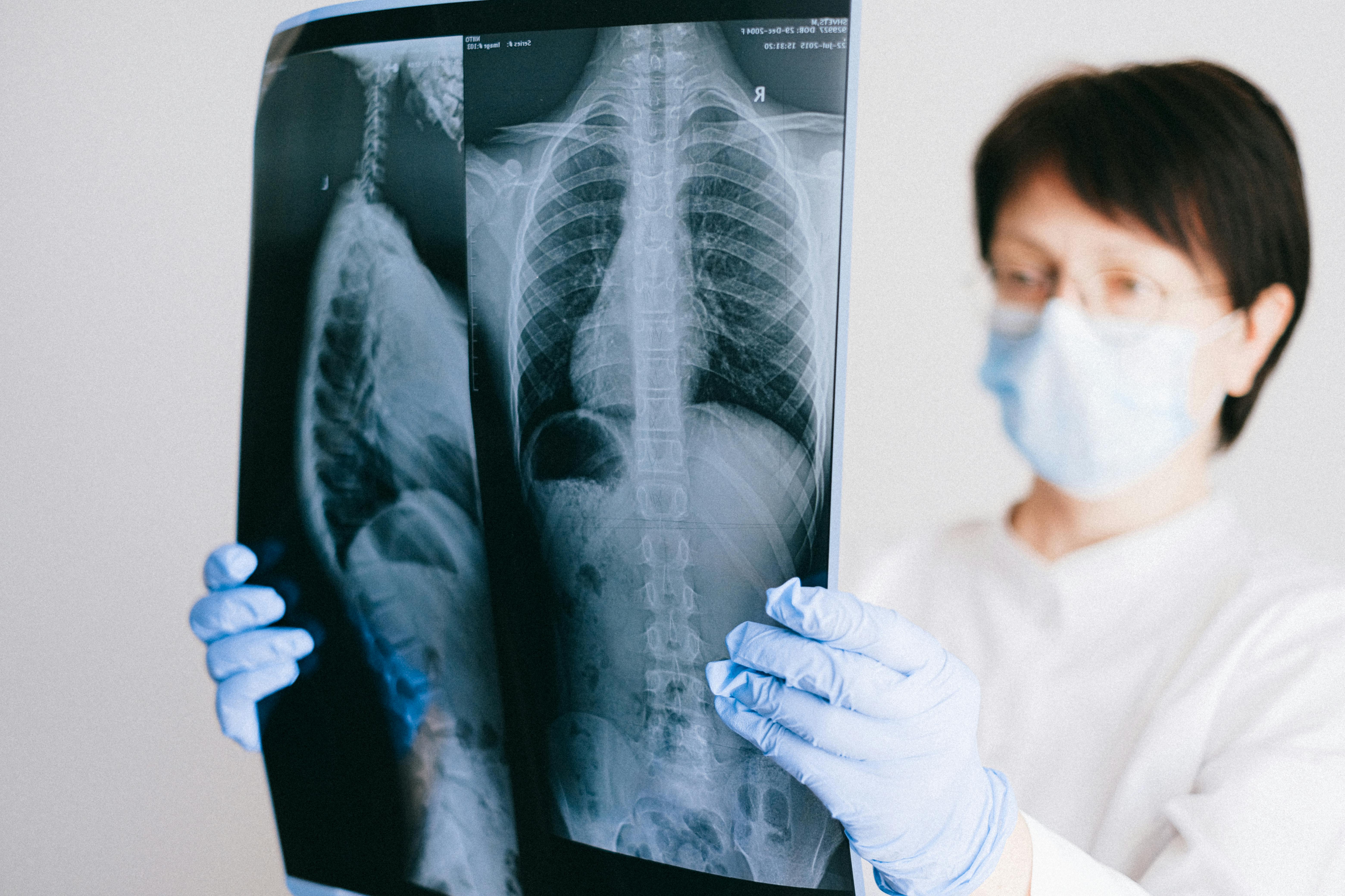 Los microplásticos inhalados inhabilitan a las células del sistema inmunitario pulmonar Los microplásticos inhalados inhabilitan a las células del sistema inmunitario pulmonar