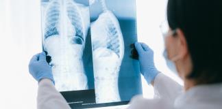 Los microplásticos inhalados inhabilitan a las células del sistema inmunitario pulmonar