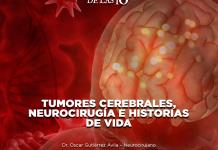 Tumores cerebrales: Neurocirugía e historias de vida - El Expresso de las 10 - Ma. 20 Mayo 2025