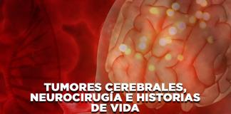 Tumores cerebrales: Neurocirugía e historias de vida - El Expresso de las 10 - Ma. 20 Mayo 2025