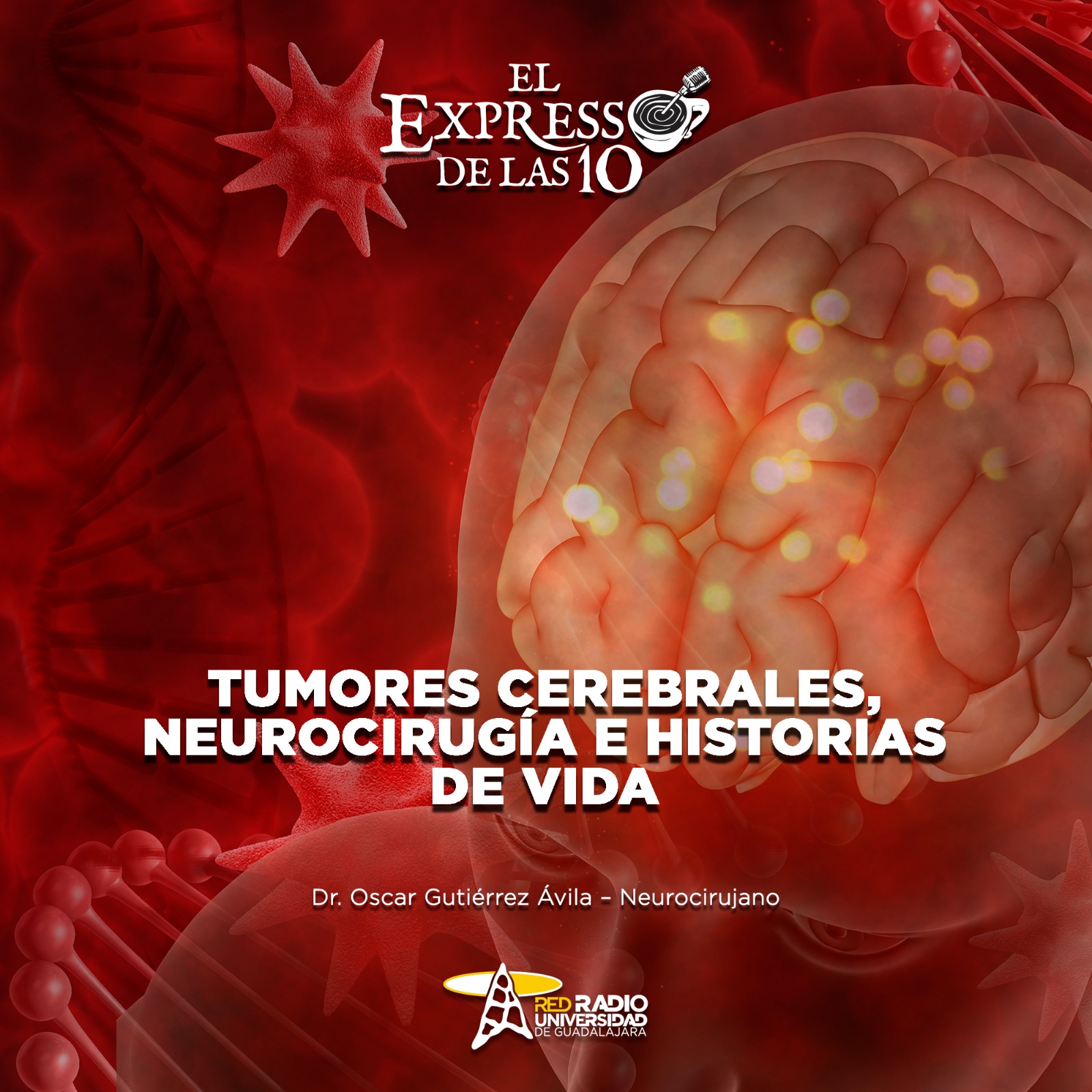 Tumores cerebrales: Neurocirugía e historias de vida - El Expresso de las 10 - Ma. 20 Mayo 2025 Tumores cerebrales: Neurocirugía e historias de vida - El Expresso de las 10 - Ma. 20 Mayo 2025
