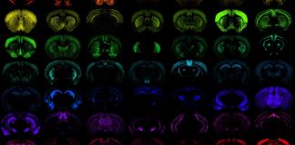 Crean una nueva generación de herramientas biológicas frente a las enfermedades cerebrales