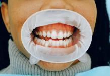¿Le duelen los dientes? Podría deberse a un pez de hace 500 millones de años