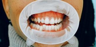 ¿Le duelen los dientes? Podría deberse a un pez de hace 500 millones de años