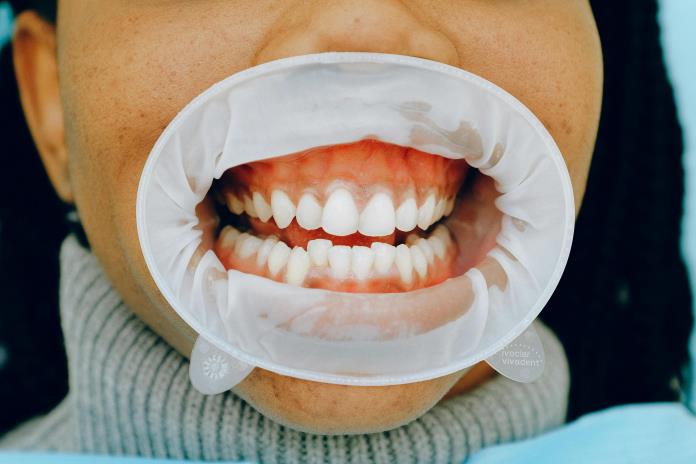 ¿Le duelen los dientes? Podría deberse a un pez de hace 500 millones de años ¿Le duelen los dientes? Podría deberse a un pez de hace 500 millones de años
