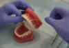 Hallazgo médico: hasta las caries pueden provocar preclampsia