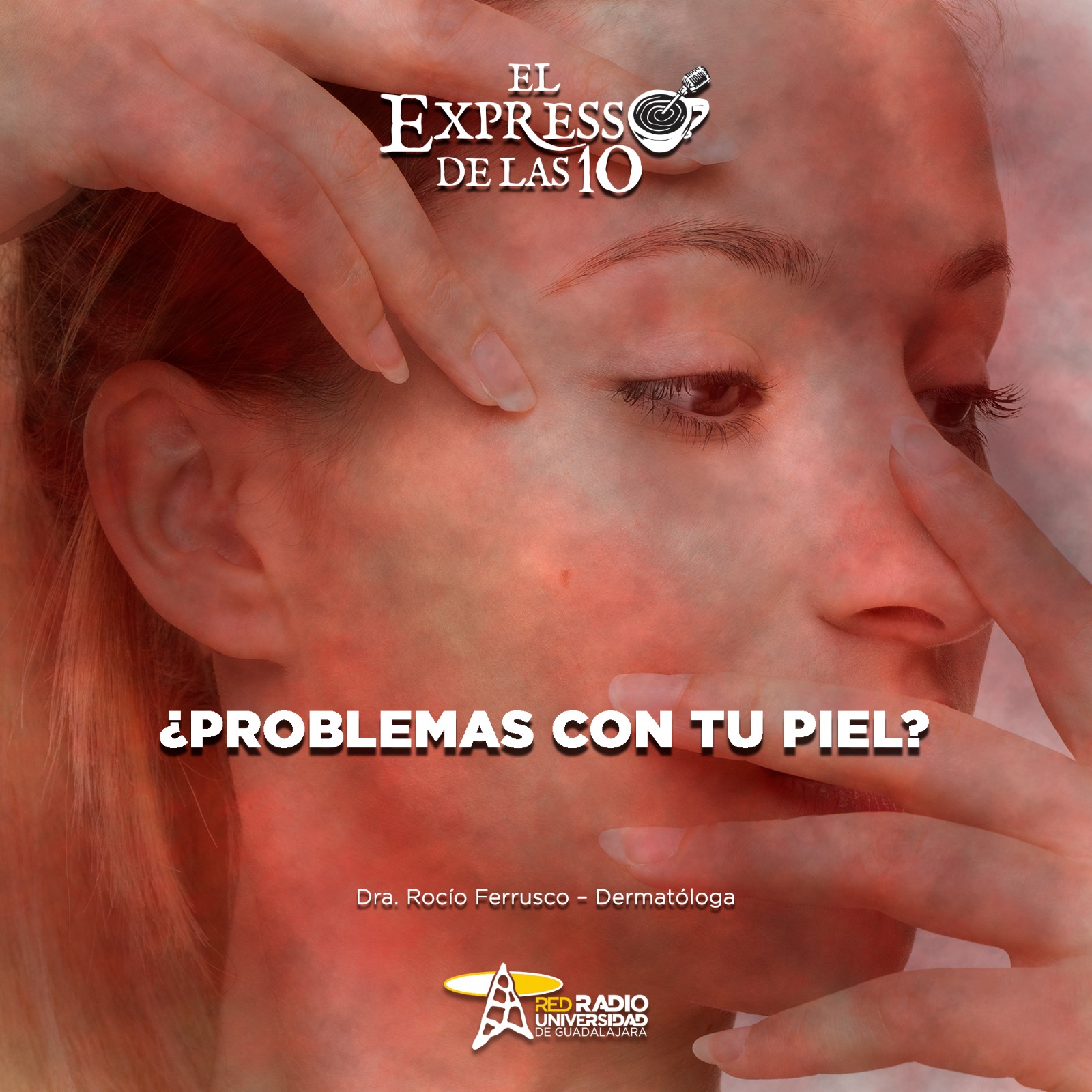 ¿Problemas con tu piel? - El Expresso de las 10 - Ma. 17 Junio 2025 ¿Problemas con tu piel? - El Expresso de las 10 - Ma. 17 Junio 2025