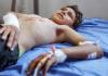 4.000 amputados en la guerra de Gaza y solo 9 profesionales formados para atenderlos