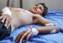 4.000 amputados en la guerra de Gaza y solo 9 profesionales formados para atenderlos