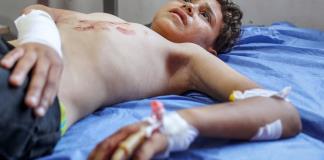4.000 amputados en la guerra de Gaza y solo 9 profesionales formados para atenderlos