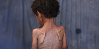 Israel y palestinos se acusan en la ONU del hambre en Gaza
