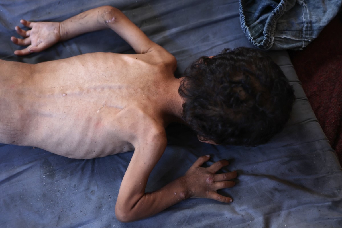 Un periodista relata su día a día frente al riesgo de hambruna mientras cubre la guerra en Gaza Un periodista relata su día a día frente al riesgo de hambruna mientras cubre la guerra en Gaza