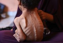 Más de 100 ONG advierten de hambruna masiva en Gaza