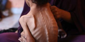 Más de 100 ONG advierten de hambruna masiva en Gaza