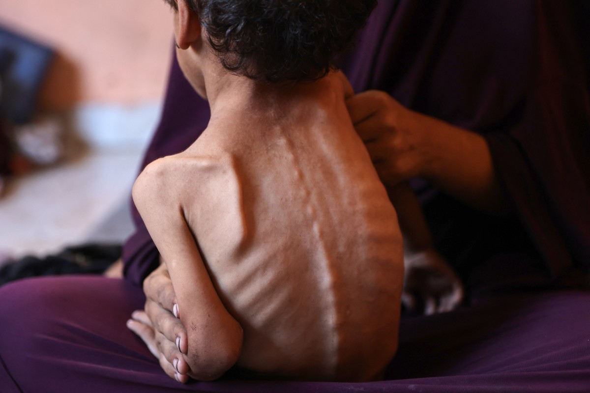 Más de 100 ONG advierten de hambruna masiva en Gaza